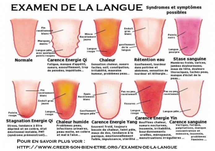 Photo numéro 8 de la galerie de Nathalie Buisson : Énergétique Traditionnelle Chinoise à Gujan-Mestras. Prendre RDV