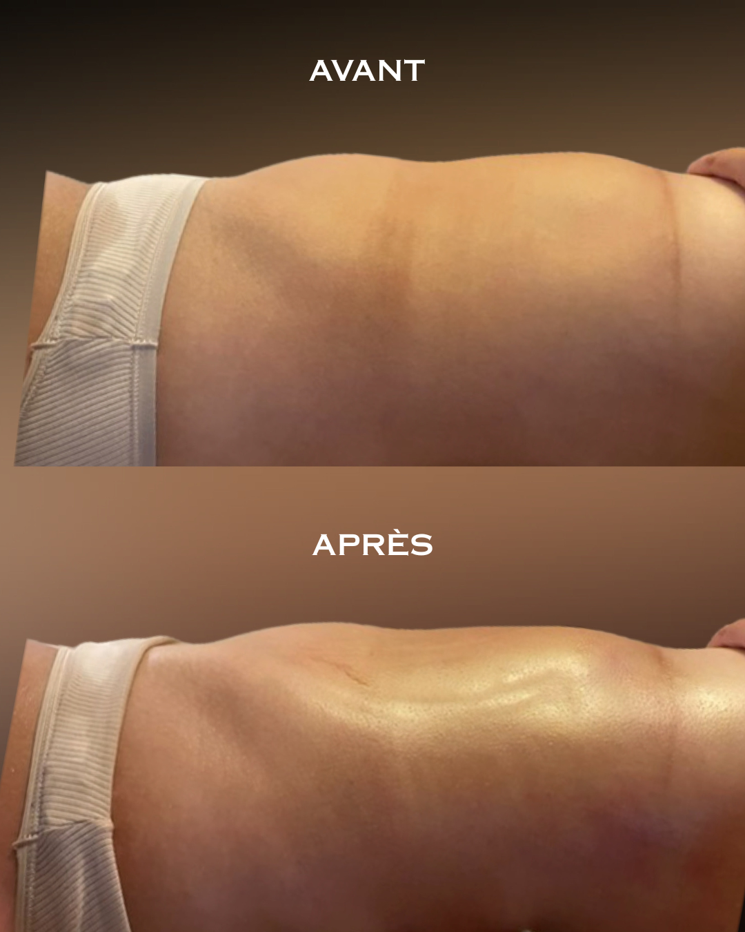 Photo numéro 4 de la galerie de Thiphaine De Kerdanet : Masseur bien-être à Paris 19e Arrondissement. Prendre RDV